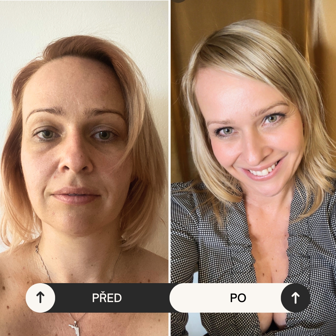 21denní face fitness výzva – cvičení obličeje 5 minut denně